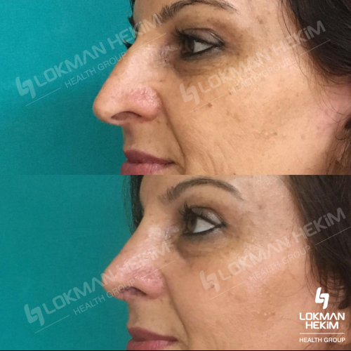 наших пациентов 5